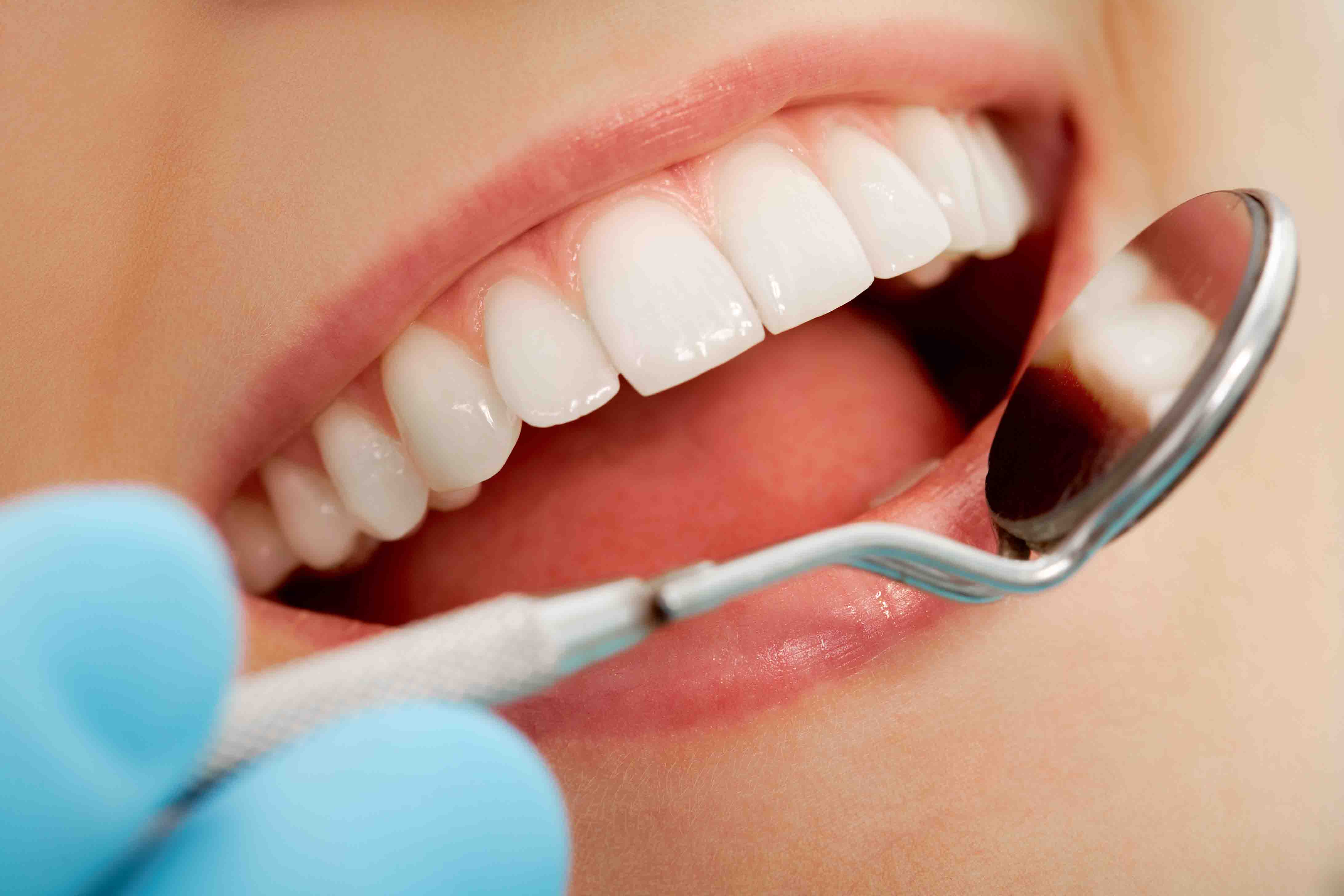 Отбеливание полости рта. Красивые зубы. Зубы стоматология. Профессиональная гигиена полости рта. Красивая улыбка зубы.